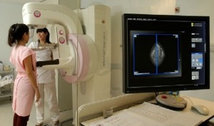 mamografia-imagenes-mamarias-ucsf